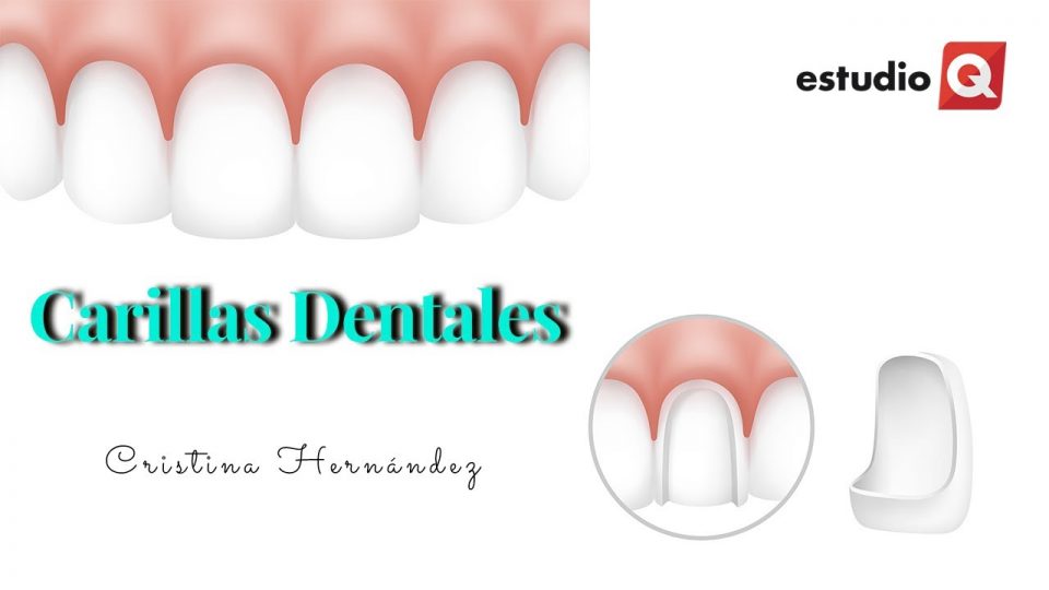 CARILLAS DENTALES O BRACKETS con CRISTINA HERNÁNDEZ
