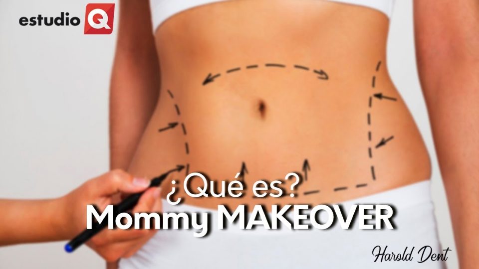 ¿QUÉ ES EL MOMMY MAKEOVER? con HAROLD DENT