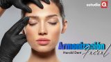 ¿QUÉ ES LA ARMONIZACIÓN FACIAL? con HAROLD DENT