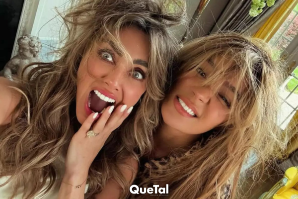 Así quedaron las heridas de Anahí tras su 'enfrentamiento' con Karol G
