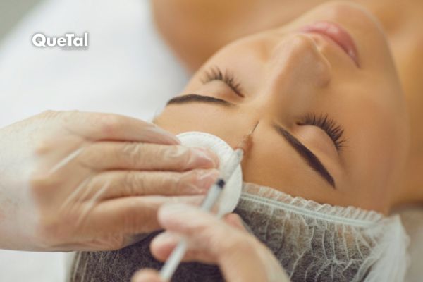 ¿Botox? Señales de que podría ser momento de considerarlo