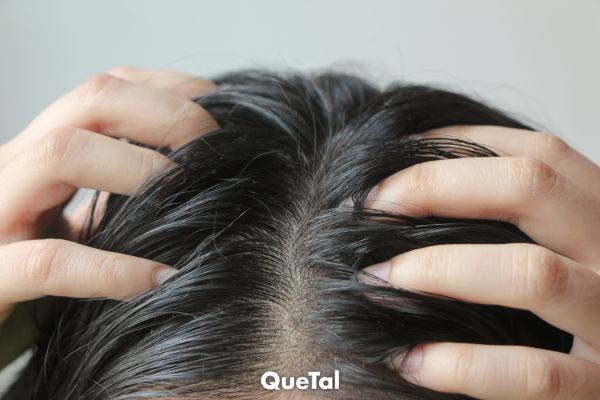 Cabello graso: causas principales y cómo mantenerlo bajo control