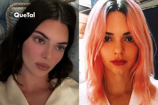 Kendall Jenner rompe el silencio sobre sus supuestas cirugías faciales