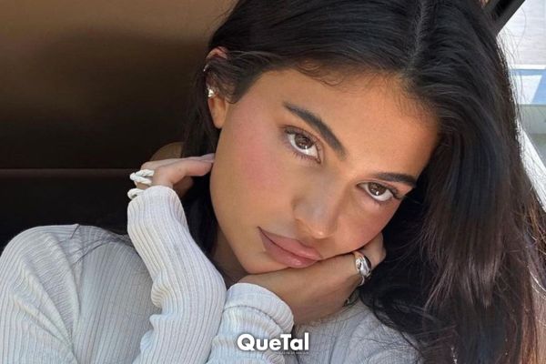Kylie Jenner niega haberse hecho cirugías en la cara y el internet reacciona