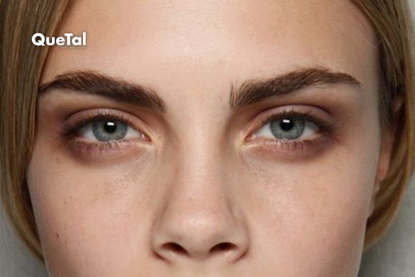 Guía express para eliminar ojeras