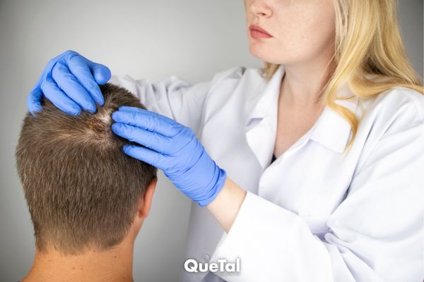 Mesoterapia capilar, la técnica poco conocida contra la caída del cabello