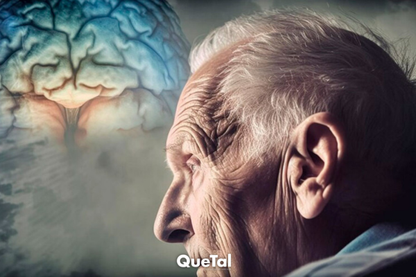 Esta es la segunda causa más común de deterioro cognitivo tras el alzhéimer